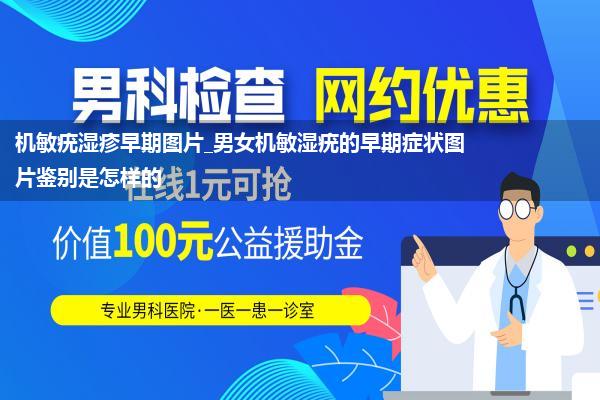 机敏疣湿疹早期图片_男女机敏湿疣的早期症状图片鉴别是怎样的